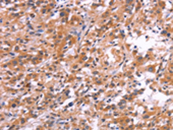APMAP / C20orf3 Antibody
