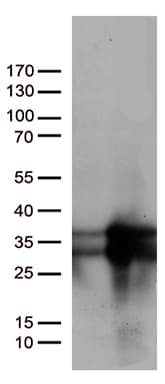 MGMT Antibody (clone OTI17H4)