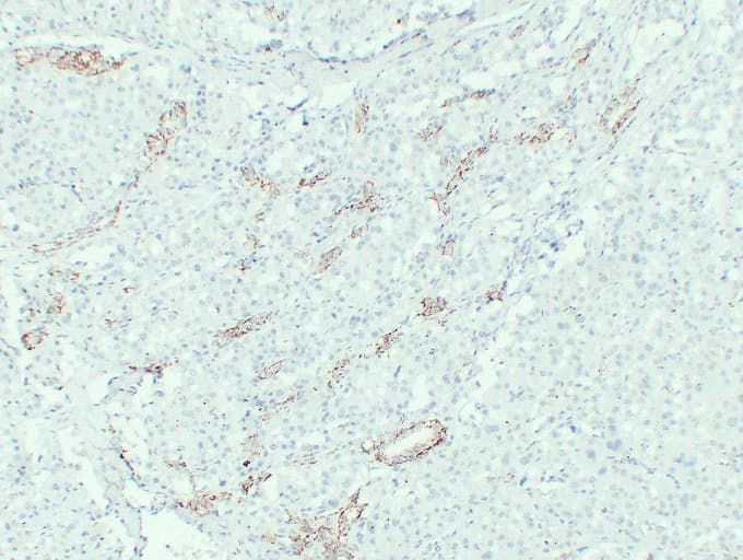 CLDN7 / Claudin 7 Antibody (clone ABT-CLD7)