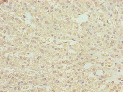 PHF13 Antibody