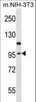 EEF2K Antibody (aa178-205)
