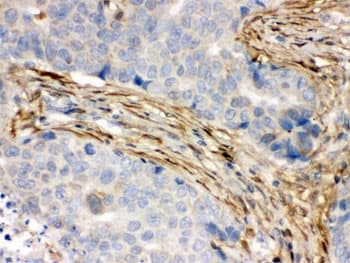 S100A6 / Calcyclin Antibody