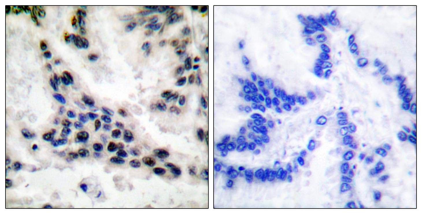 Polyclonal Rabbit anti-Human HDAC1 Antibody (IHC, IF, WB)