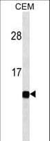 B2M / Beta 2 Microglobulin Antibody (aa10-39)