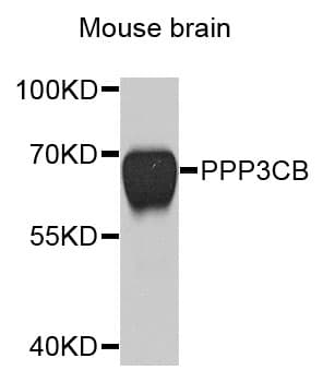 PPP3CB Antibody
