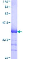 Human CDC42BPB / MRCKB Protein (Recombinant GST, N-terminus)