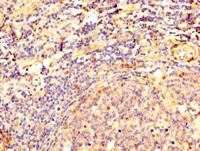 DSG3 / Desmoglein 3 Antibody (aa70-615)