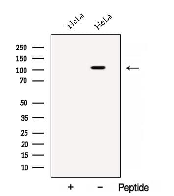 Polyclonal Rabbit anti-Human BRD2 / RING3 Antibody (WB)