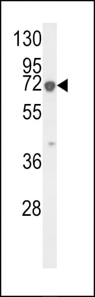 KRT9 / CK9 / Cytokeratin 9 Antibody (aa302-331)