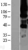 Human PRKCH / PKC-Eta Protein (Over-Expression Lysate Myc-DDK (Flag))