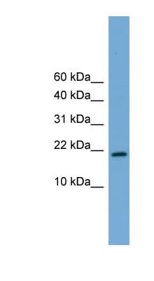 CITED4 Antibody (aa51-100)