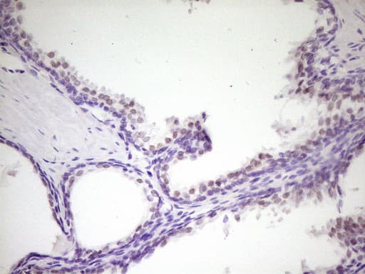 HIPK1 Antibody (aa439-697, clone OTI5F1)