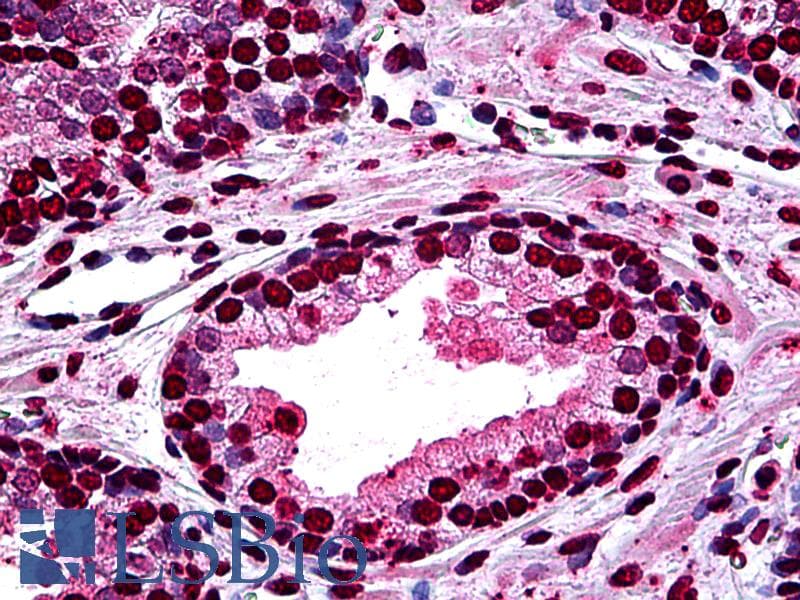 IHC-plus™ Monoclonal Mouse anti-Human DLX2 Antibody (clone 2C8, IHC, WB)