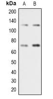 Polyclonal Rabbit anti-Human RAD21 Antibody (C-Terminus, IHC, IF, WB)