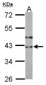 Polyclonal Rabbit anti-Human B3GNT3 / TMEM3 Antibody (aa122-338, IHC, WB)