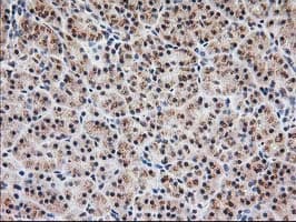 MGLL / Monoacylglycerol Lipase Antibody (clone OTI4D1)