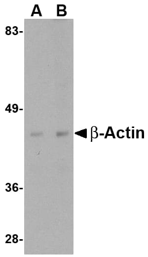 ACTB / Beta Actin Antibody