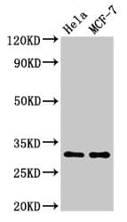 Polyclonal Rabbit anti-Human HIST1H1B Antibody (phospho-Thr154, WB)