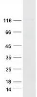 Human CD44 Protein (Recombinant Myc-DDK (Flag))