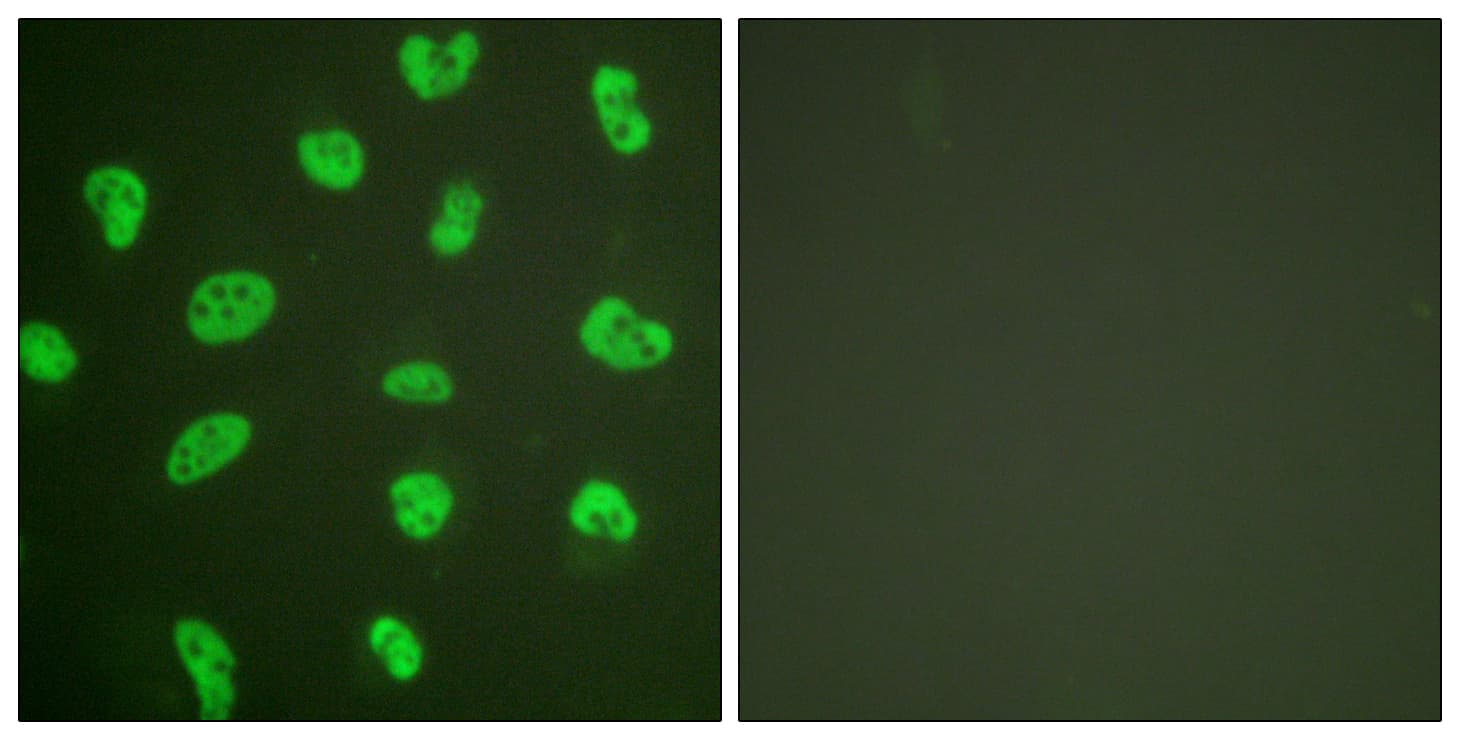 IHC-plus™ PRKDC / DNA-PKcs Antibody (aa4061-4110)