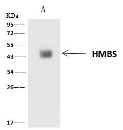 HMBS / PBGD Antibody