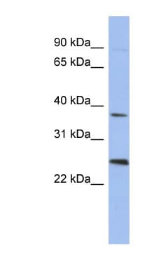 MAGEB2 Antibody (aa71-120)