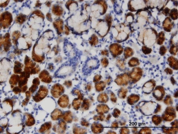 Monoclonal Mouse anti-Human TCN1 Antibody (clone 3F10, IHC, WB)