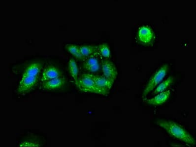 Polyclonal Rabbit anti-Human PRKAR2A Antibody (IHC, IF, WB)