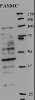 Polyclonal Rabbit anti-Human RFC5 Antibody (aa170-200, WB)