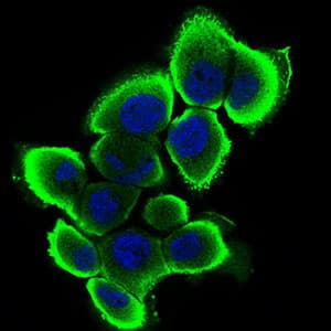 SERPINA7 / TBG Antibody (aa168-302, clone 5B11E9)