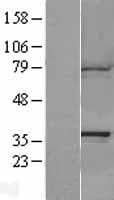 CAPZA1 / CAPZ Alpha 1 Protein (Over-Expression Lysate Myc-DDK (Flag))