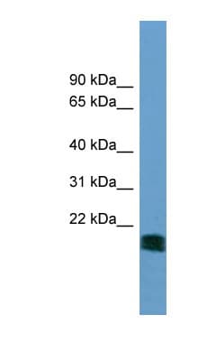 NT5M Antibody (aa35-84)