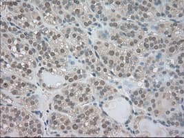 Monoclonal Mouse anti-Human NTRK3 / TRKC Antibody (clone OTI4E10, IHC, IF, WB)