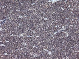 ESRRG / ERR Gamma Antibody (aa24-263, clone OTI1E5)