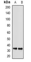 SGTA / SGT Antibody