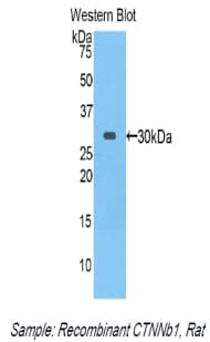 CTNNB1 / Beta Catenin Antibody (aa409-665, PE)