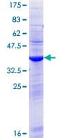 Human TXLNGY / CYorf15B Protein (Recombinant GST)