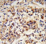 CORNIFIN / SPRR1B Antibody (aa63-89)