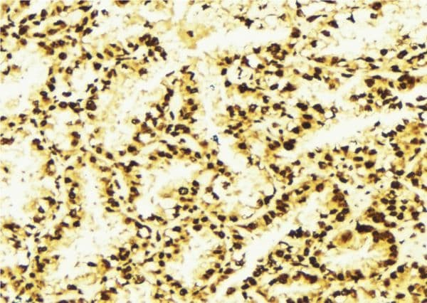 PSMD10 / Gankyrin Antibody