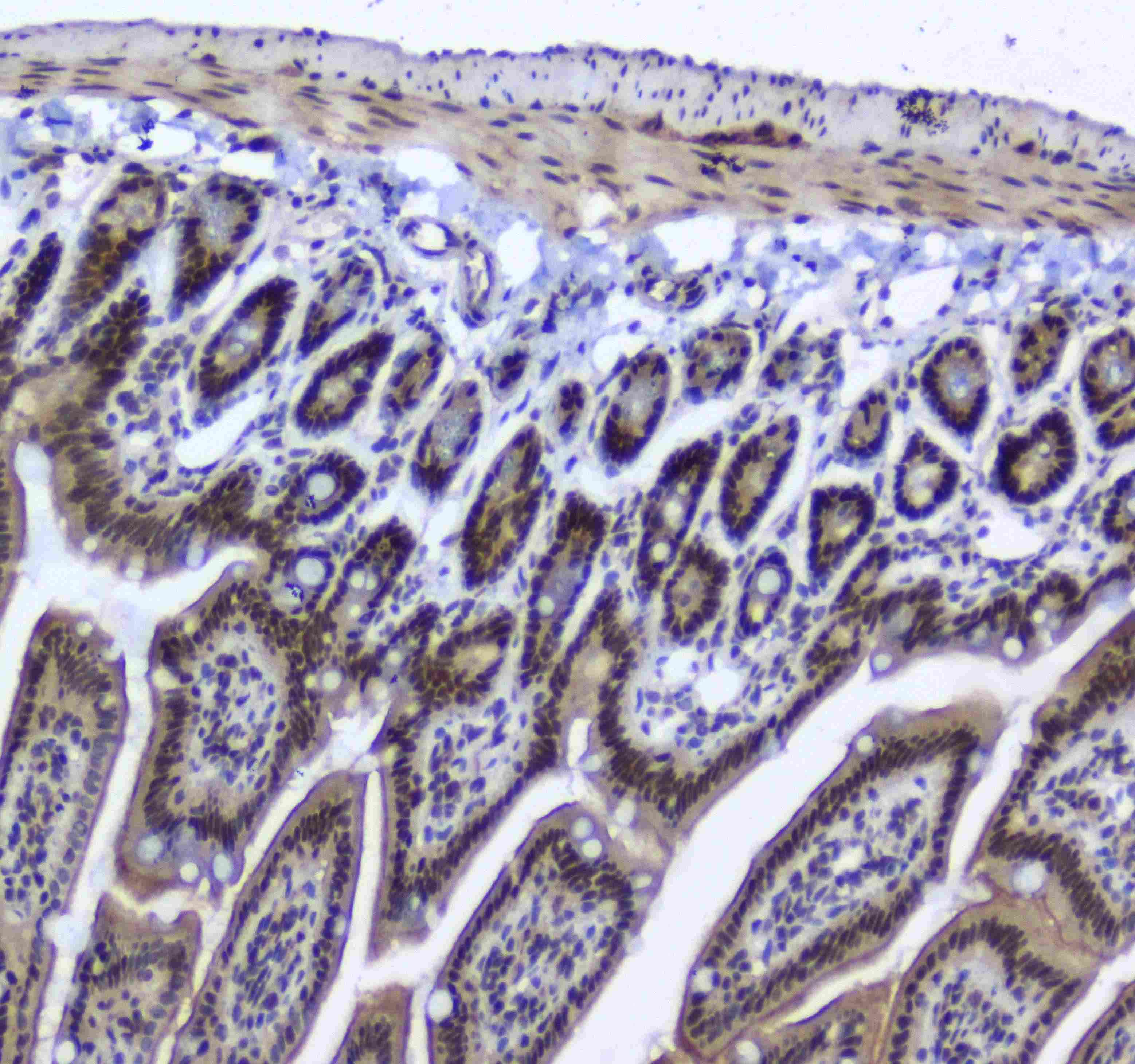 SF1 Antibody