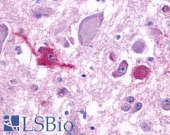 PathPlus™ Polyclonal Rabbit anti-Human QRFPR / GPR103 Antibody (Cytoplasmic Domain, IHC)