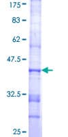 Human ST3GAL6 Protein (Recombinant GST, N-terminus)
