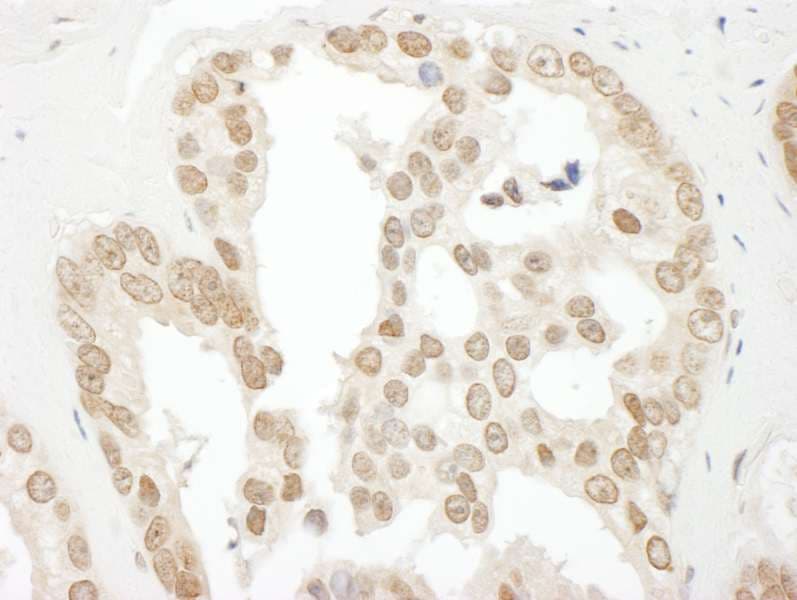 BCCIP Antibody (aa250-C-term)