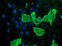 RASSF1 / RASSF1A Antibody (clone OTI8E2)