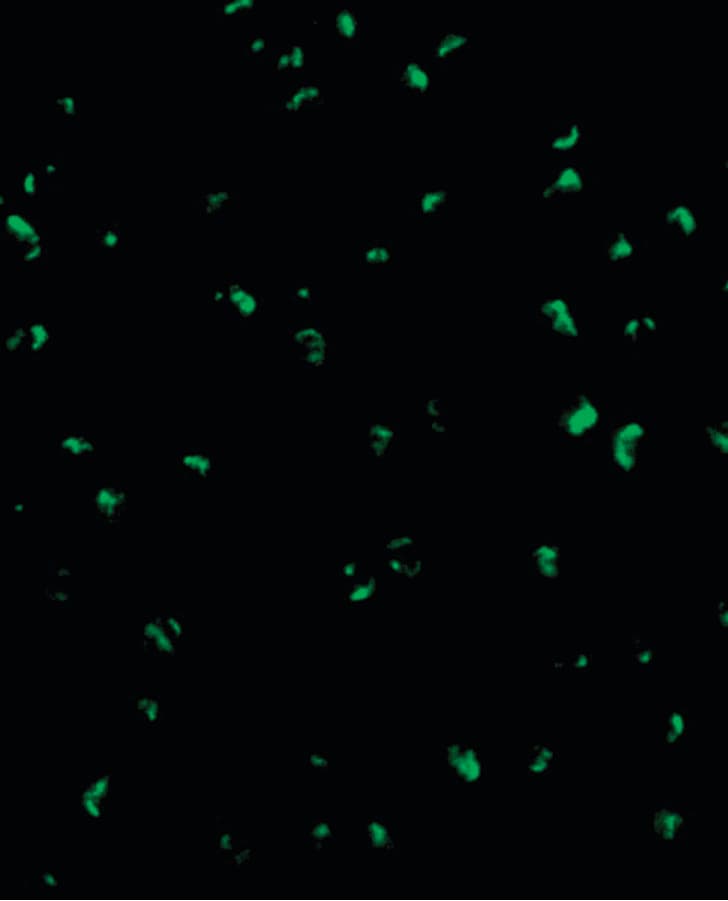 PathPlus™ Polyclonal Rabbit anti-Human ACIN1 / Acinus Antibody (IHC, IF, WB)