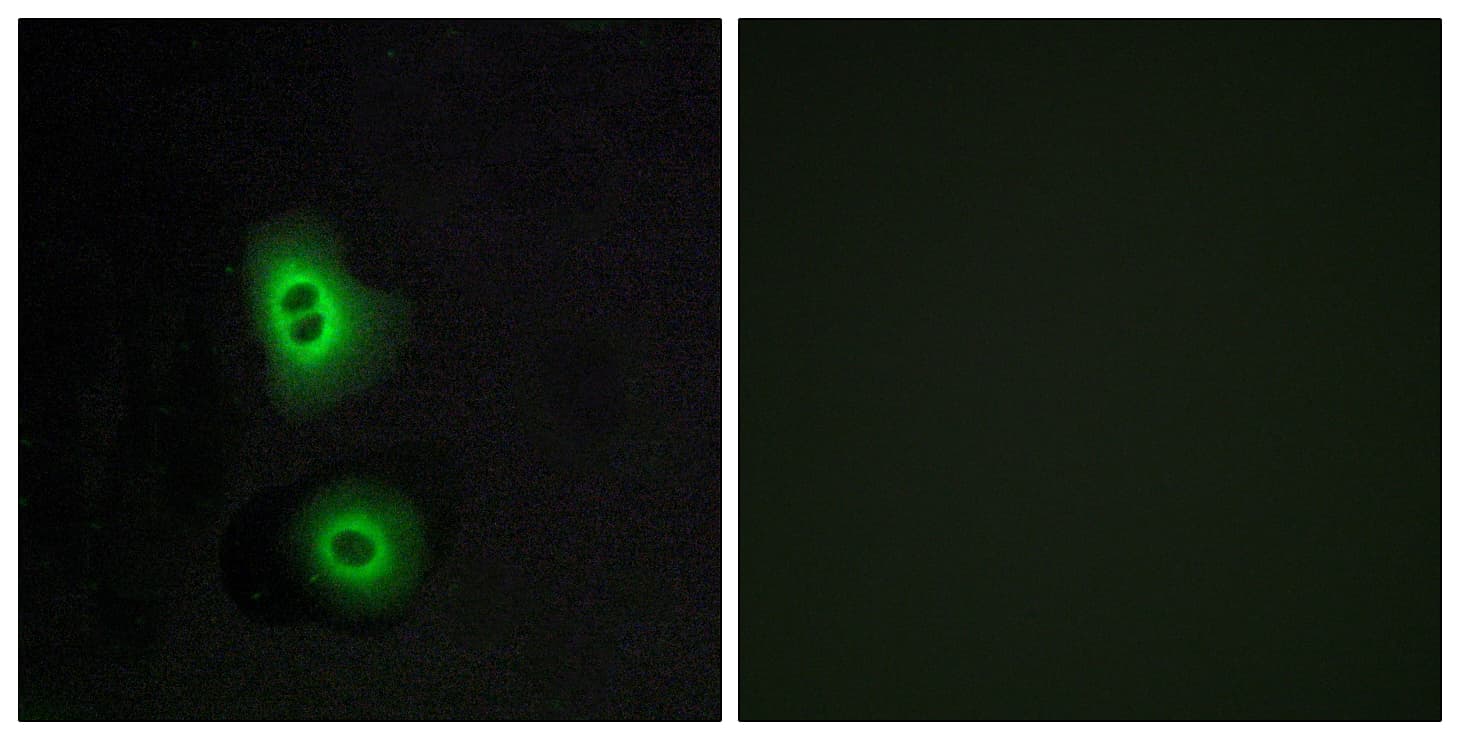 OR4C16 Antibody (aa261-310)