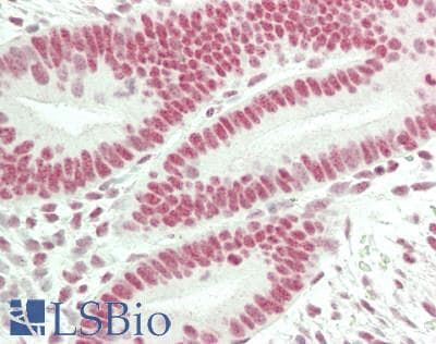 IHC-plus™ Requiem / DPF2 Antibody (aa125-174)