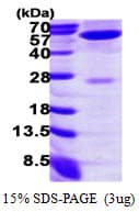Human GMDS / GMD Protein (Recombinant His)