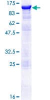 Human SSH3 Protein (Recombinant GST)