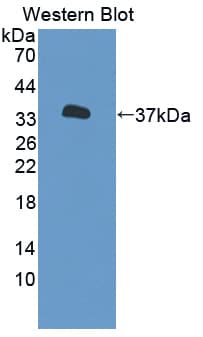 P2RX7 / P2X7 Antibody (aa47-334, FITC)